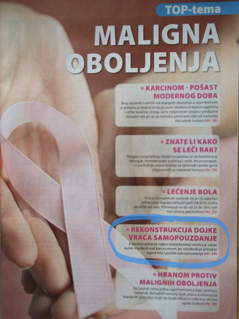 rekonstrukcija dojke