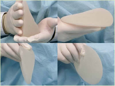 Gummy-bear-implant-X-4-PS101dotBLOGSPOTdotCOM